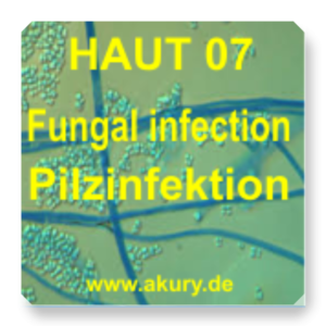 HAUT 07 Fungal infections