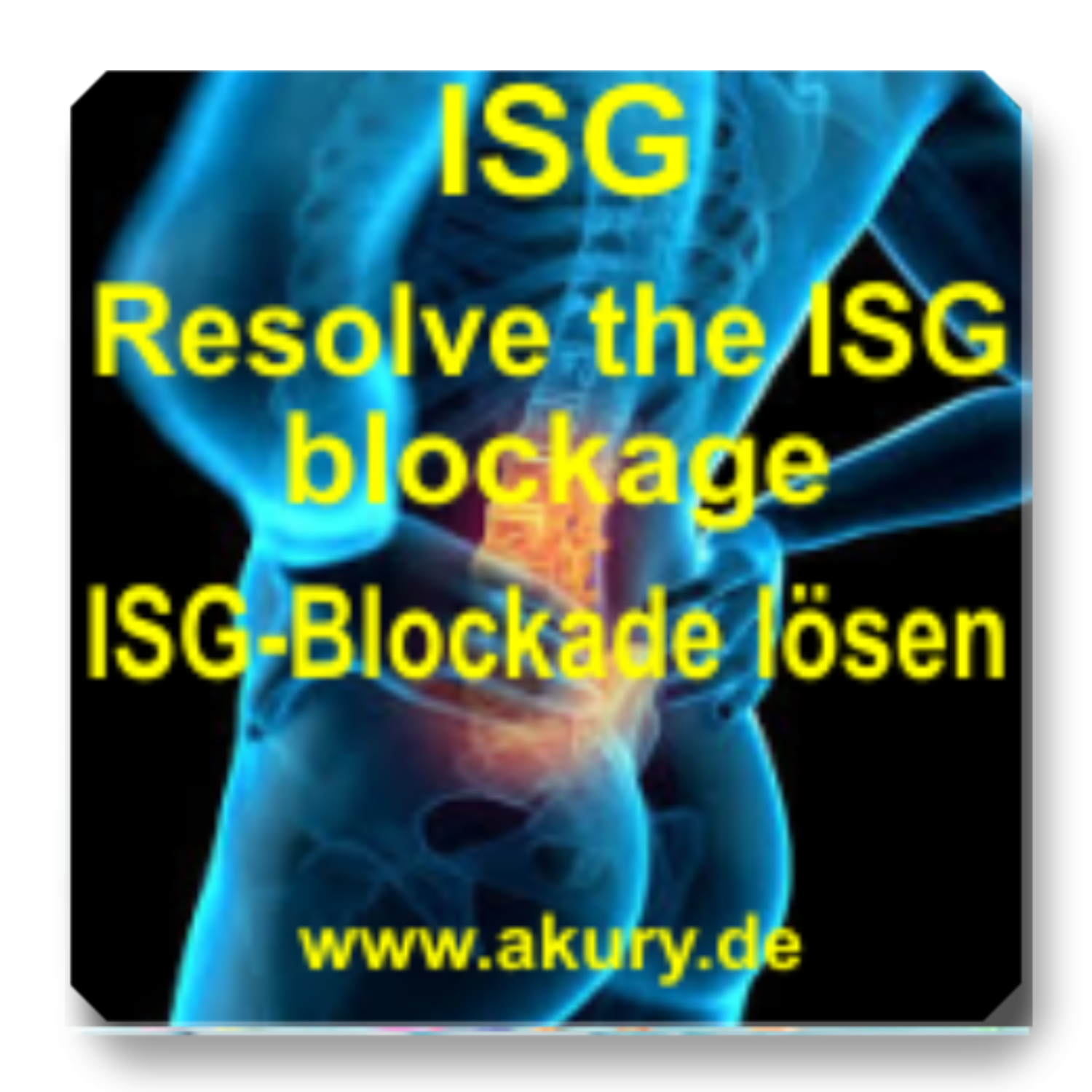 ISG Resolve ISG blockages